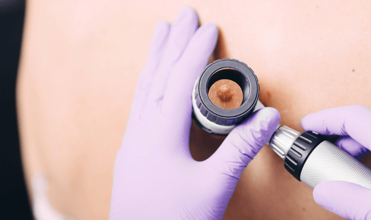 Quiz Dermatologie avec cas cliniques